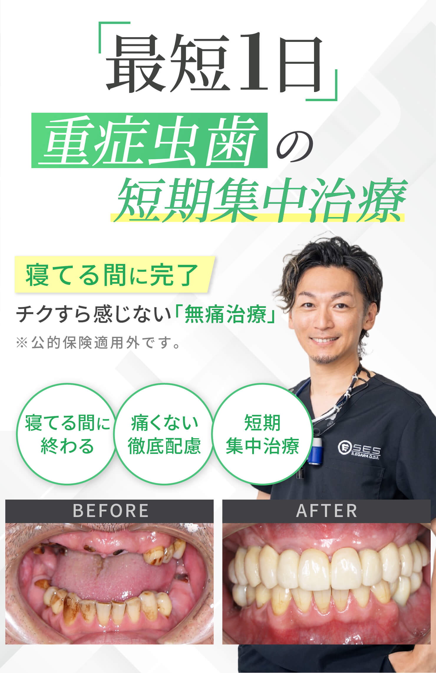 最短1日で歯をキレイに。怒りません、責めません、恥ずかしくありません。重症虫歯の集中治療